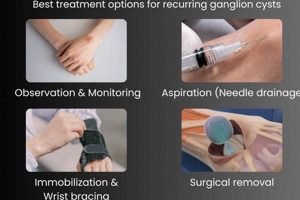 Natural Relief: Herbal Treatment for Ganglion Cyst Options | The Ultimate Herbal Remedies Guide: Natural Healing for a Healthier Life