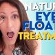 Natural Eye Floaters Treatment? Herbal Help + Tips | The Ultimate Herbal Remedies Guide: Natural Healing for a Healthier Life