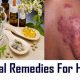 Natural Herpes Herbal Treatment: Relief & Remedies | The Ultimate Herbal Remedies Guide: Natural Healing for a Healthier Life