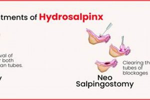 Natural Herbal Treatment for Hydrosalpinx: A Guide The Ultimate Herbal Remedies Guide: Natural Healing for a Healthier Life Natural Herbal Treatment for Hydrosalpinx: A Guide | The Ultimate Herbal Remedies Guide: Natural Healing for a Healthier Life