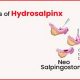 Natural Herbal Treatment for Hydrosalpinx: A Guide | The Ultimate Herbal Remedies Guide: Natural Healing for a Healthier Life