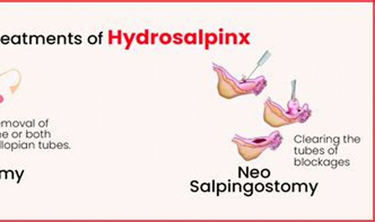Natural Herbal Treatment for Hydrosalpinx: A Guide The Ultimate Herbal Remedies Guide: Natural Healing for a Healthier Life Natural Herbal Treatment for Hydrosalpinx: A Guide | The Ultimate Herbal Remedies Guide: Natural Healing for a Healthier Life