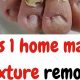 Natural Toenail Fungus Herbal Remedies: A Complete Guide | The Ultimate Herbal Remedies Guide: Natural Healing for a Healthier Life